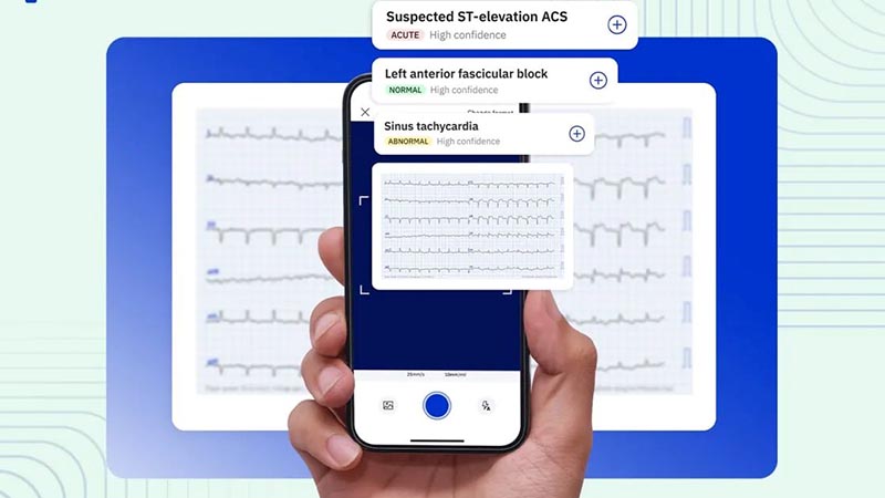 معرفی هوش مصنوعی برای ECG