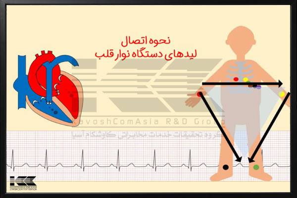 نحوه اتصال لیدهای دستگاه الکتروکاردیوگرام نوار قلب