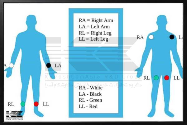جایگذاری لیدهای اندامی دستگاه نوار قلب
