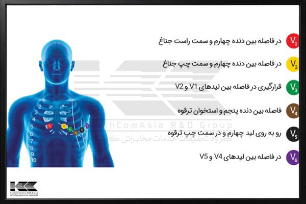 جایگذاری لید‌های (نوار قلب) قفسه سینه‌ای