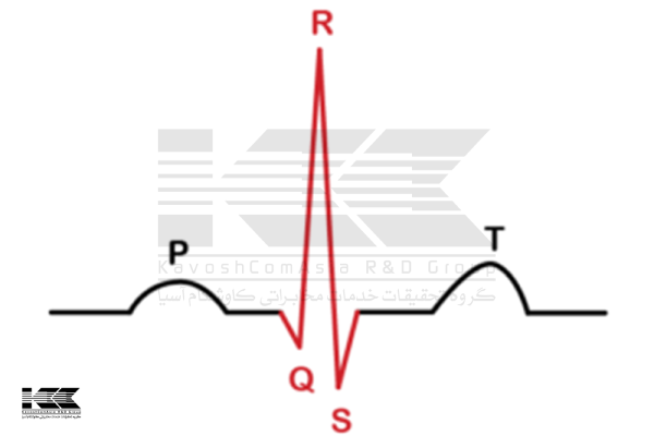 تفسیر نوار قلب: بررسی عرض کمپلکس QRS